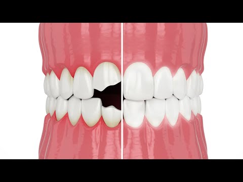 Boost Your Confidence with Cosmetic Dentistry