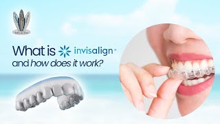 FAQ #1 What is Invisalign and how does it work?