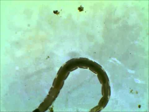 Mosquito Larvae collected from the drainage pan of flower pot