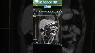 #mri #techlearner #mrimachine #mrimaster #cardiacmri #anatomy