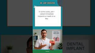 28  "What Are Dental Implants? Explained in 60 Seconds 🦷"