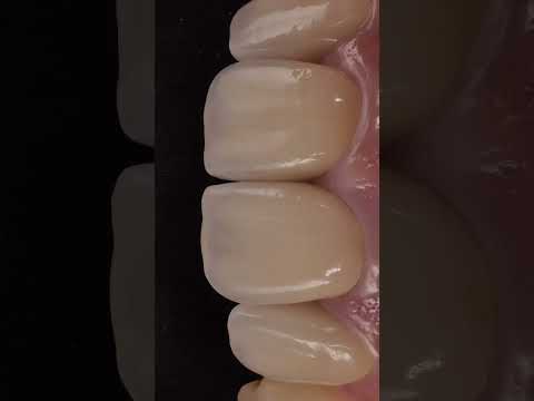 Otexe — all courses for dentists in one place! 🦷 #dental #dentist #dentistryworld