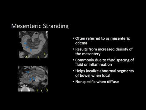The Mesentery
