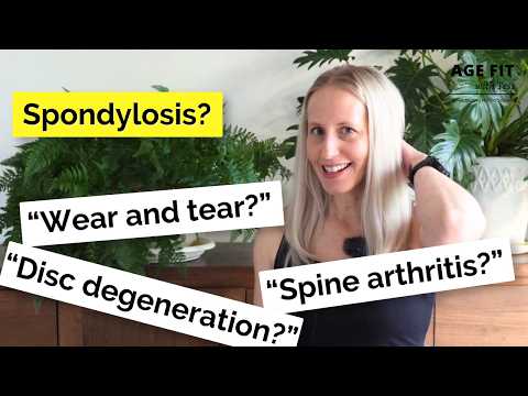 What Is Spondylosis? (And What Actually Helps)
