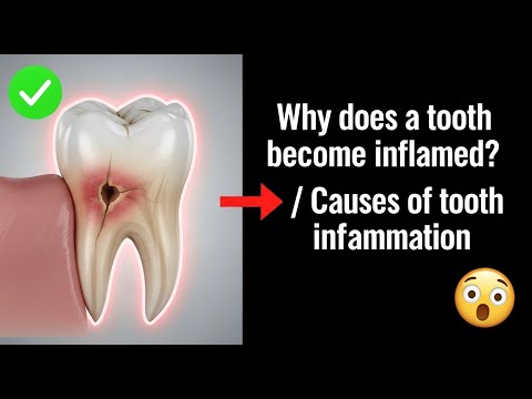 ✅ Why does a tooth become inflamed? / Causes of tooth inflammation 👈😳