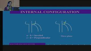 AIOC2018 - IC235 - Topic - Factors affecting astigmatic outcomes in SICS - Dr.DIVYA M.