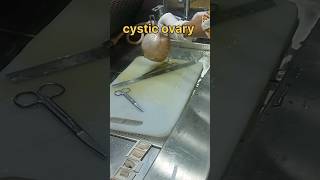 Cystic ovary grossing| சிஸ்டிக் கருமுட்டை | #ovariancyst #tissuefixation #treatmentforallbodyparts