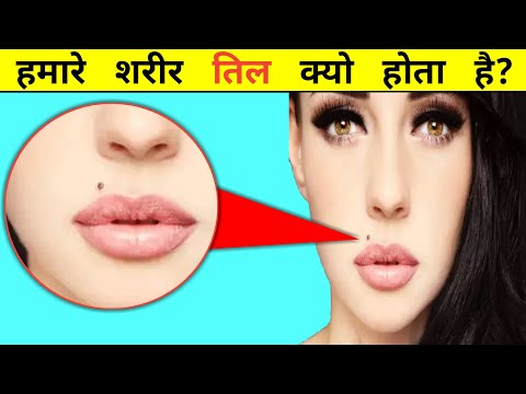 हमारे शरीर मे तिल कैसे बनता हैं? 🤔 | Prime Duniya l | #shorts #mole #ytshorts