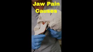 TMJ pain explained #dentist #answer #tmj #tmjpain #jawpain #dentisteducation #dentistexplains
