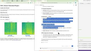 Interactive EEG Seizure Detection with RhythmScan: Exploring Machine Learning & Biomedical Data
