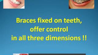 Quick fix solutions ! Are they worth it ?!?!