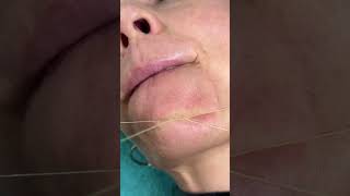 Chin Threading                               #threading #facethreading #threadingtutorial
