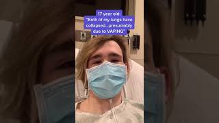 Can Vaping Collapse Your Lungs? Spontaneous Pneumothorax! #shorts