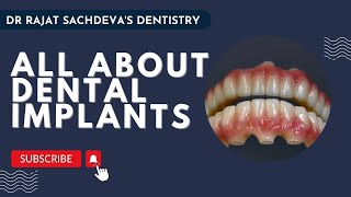 All about dental implants from Dr rajat sachdeva