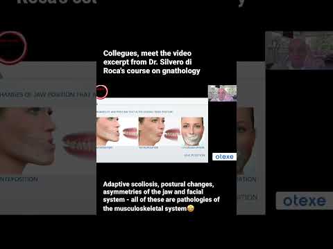 Dr. Roca discusses the treatment of these pathologies in his course on gnathology👍🏻 Subscribe 💙