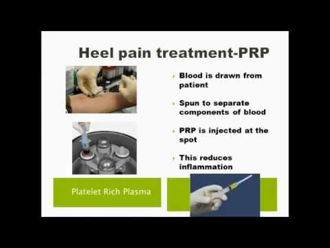 Heel pain treatment in Hyderabad