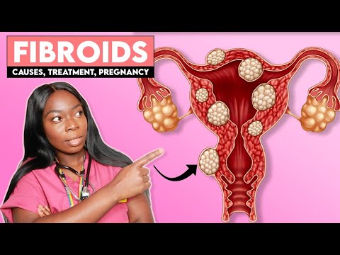 HOW to Treat UTERINE FIBROIDS | Causes, Symptoms, Treatment, Surgery, Pregnancy/Fertility