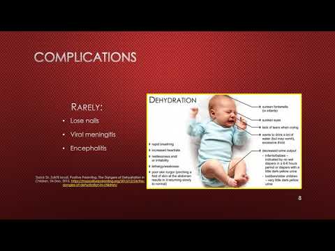 Hand, Foot, and Mouth Disease video