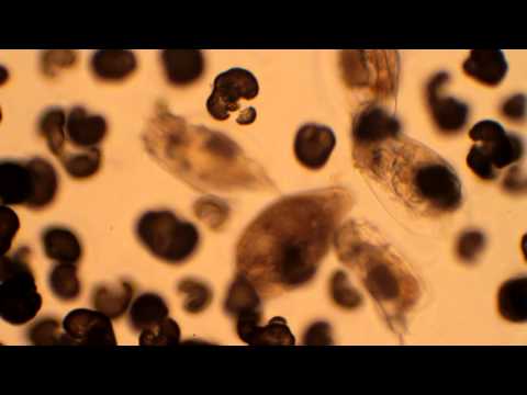 Lives in a dirty pond - Stentor, Rotifer, Flat worm and Green Algae