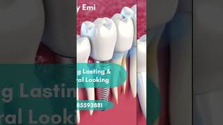 #Dental implants for missing teeth #chennaidentist #chennaidentalclinic #dentalimplants #dental l