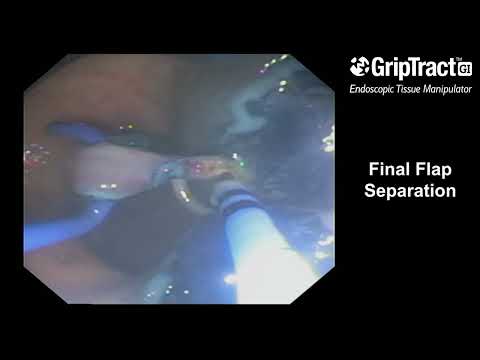 GripTract Fingers holding flap during final cut