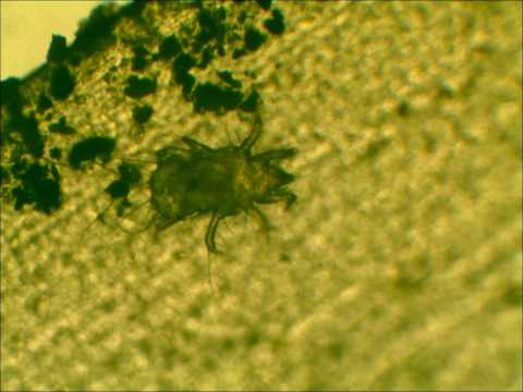 Live house mite under microscope
