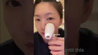 You're tired of acne and rough skin #skincare #koreanskincare #acneskincare #kbeauty #youtubeshorts