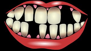 how can you make a loose tooth fallout without pain|loose tooth fallout without pain