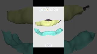 How to create a Digital Immediate Denture