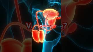 Worried about a Varicocele? #varicocele #menshealth #selfcheck