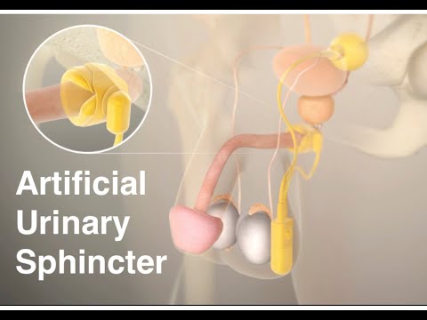 Artificial urinary sphincter (AUS)
