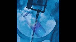 I have nothing to say… just this ultrasound #whatwasthat #addtoplaylist #lordesummer #ultrasound
