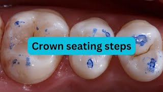 How to check crown seating?