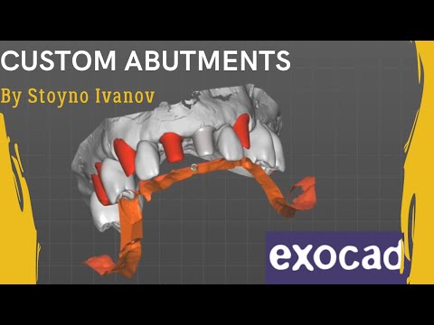 Fastest Exocad Video Tutorial - How To Design Custom Abutments