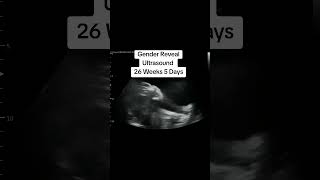 Gender Reveal Ultrasound at 26 Weeks 5 Days Pregnant #heybabymobile #26weeks5dayspregnant #babyscan
