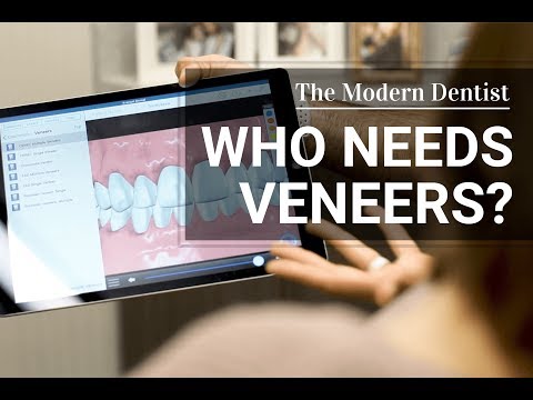 Are Veneers for You? | The Modern Dentist