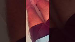 Hot water Dialysis therapy at home