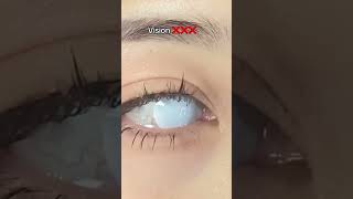 White contacts try-on #contacts #makeup #lenspoison #halloween #contactlenses