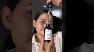 Minimalist 10% Vitamin C Serum Review 7 Days Challenge #7dayschallenge #minimalist #ashortsaday