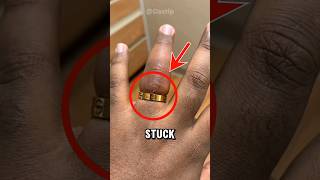 how to remove a ring stuck on finger