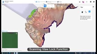 3D Runyes Intra Oral Scanner Dental Lab Digital Impression System CAD CMD Intraoral Scanner