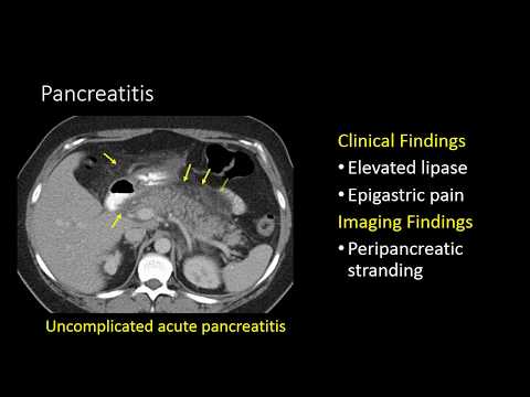 GI Imaging - Pancreatitis