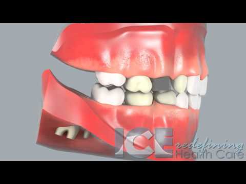 Dental Development (Lateral View)