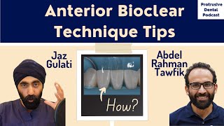 Anterior Bioclear Technique Tips with Dr Abdelrahman Tawfik - Bonus Episode