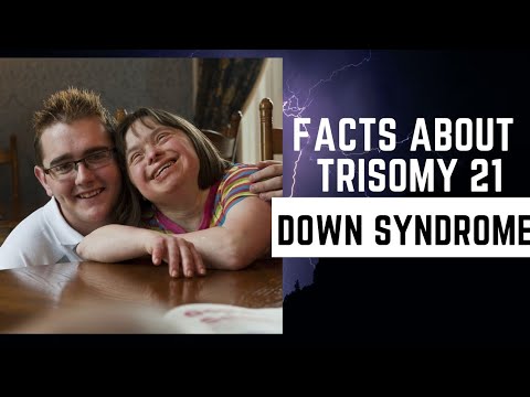 Down Syndrome (Trisomy 21) - Introduction, Facts, Symptoms And Age  #trisomy21  #downsyndrome