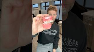 Can Orthodontists Tell If You Haven’t Been Wearing Your Rubber Bands? 👀