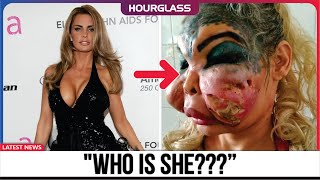 She was Beautiful, Until Plastic Surgery Went Wrong | Then and Now 2025