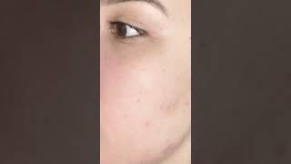 You started using Klued Multi-Brightening Complex Serum 🤭🤗🤗 #klued #kluedskin #skin #serum