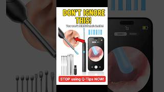 “STOP Using Q-Tips! Earwax Cleaner With Camera 😱| Best Ear Cleaning Gadget 2025 | #earwaxremoval