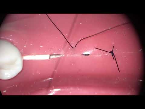 أنواع الغرز أثناء الجراحة-Types of stitches during surgery